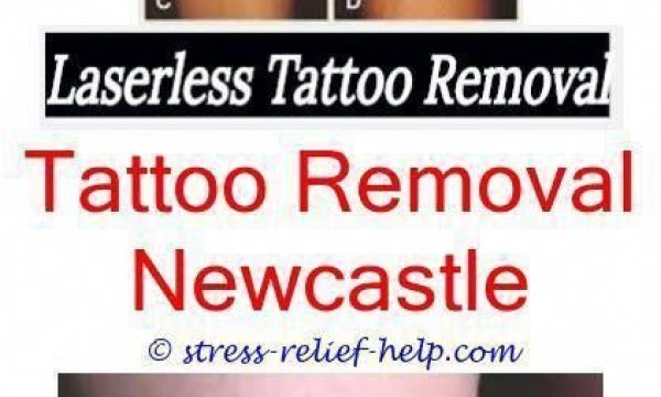 Want Find Out More About Tattoo Extermination?