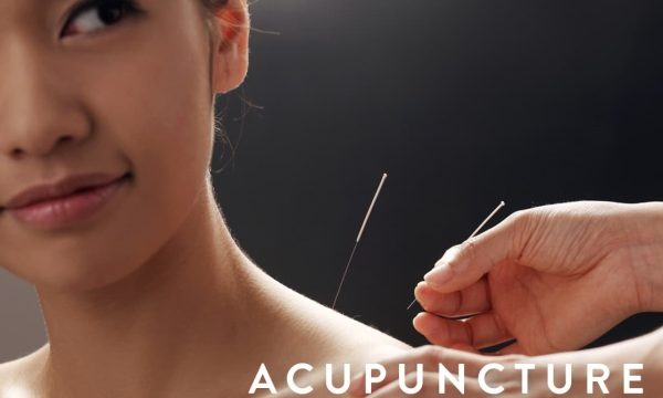 The Ancient Art of Acupuncture: Unveiling the Healing Power of Needles