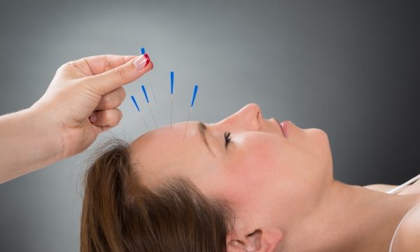 The Ancient Art of Needle Therapy: Unveiling the Wonders of Acupuncture