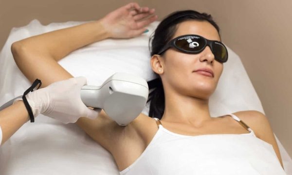 Gone in a Flash: The Ultimate Guide to Laser Hair Removal